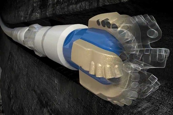 Yatay Sondaj Avantajları